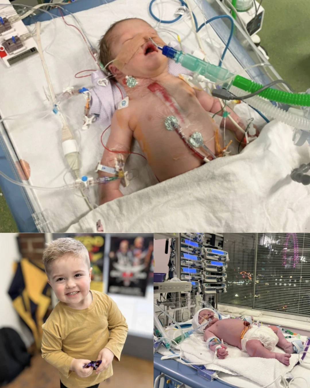 A Heart That Fights: Jake’s Journey Through Multiple Surgeries and the Power of Family Love 319