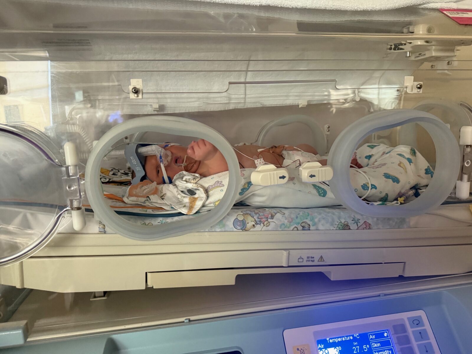 Blaire’s Journey – Our Month in NICU 5920