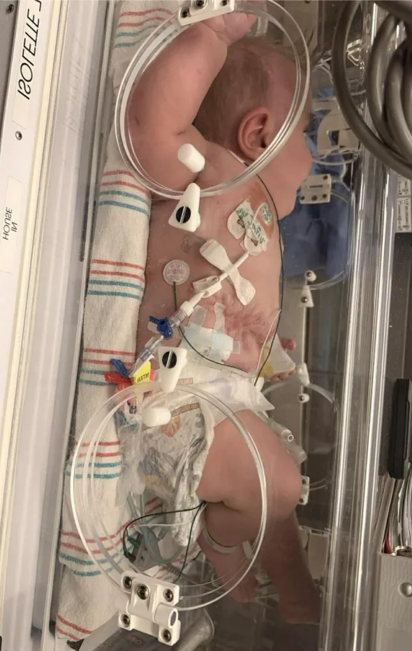 A Journey of Hope: Cooper’s Fight for Life and the Strength of His Family 4089